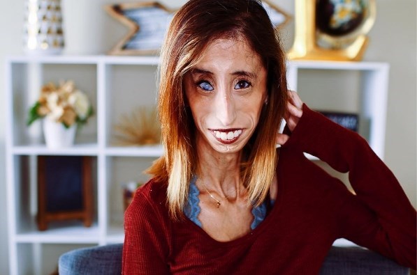 'Lelijkste meisje ter wereld' in de verdediging - De Limburger