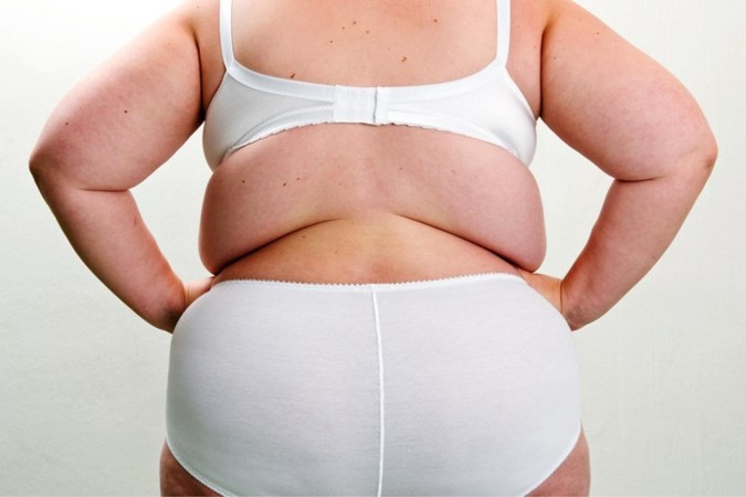 Helft Nederlanders te dik: met obesitas leef je gemiddeld zeven jaar korter