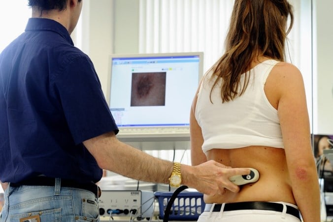 Aantal diagnoses huidkanker stijgt: ook explosieve toename in gevaarlijke melanomen