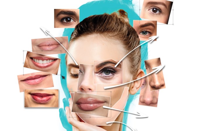 De lippen van Kylie Jenner of de kont van Kim K. Hoe ver gaan we in Limburg met cosmetische ingrepen?