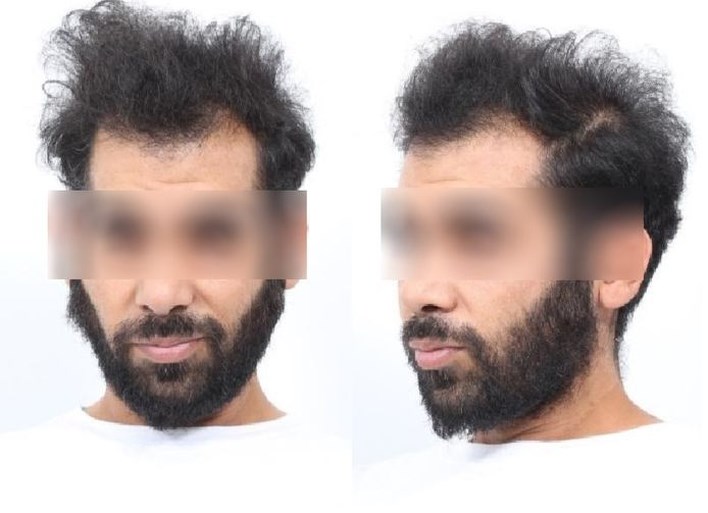 Justitie eist alleen tbs met dwangverpleging tegen zieke ‘bioscoopmoordenaar’ Ergün S.