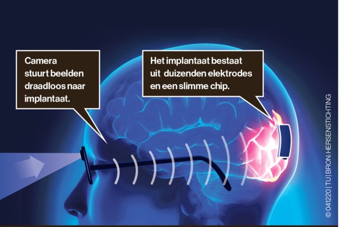 Doorbraak: onderzoekers maken een bril met camera waardoor blinden letters kunnen zien