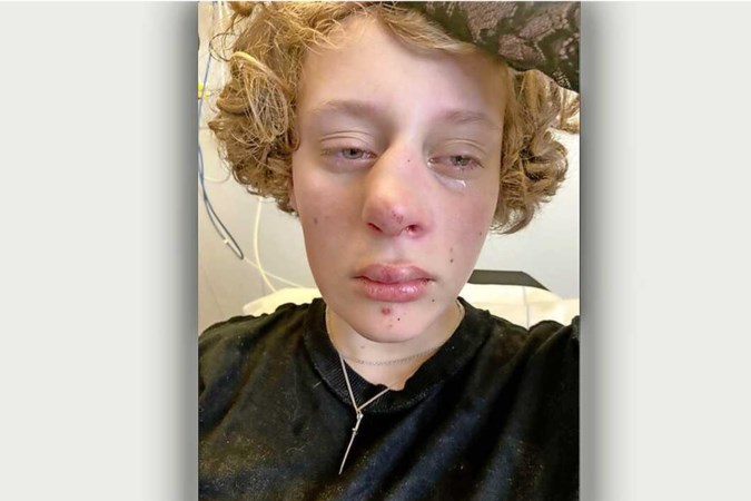 Heel Nederland leeft mee met mishandelde Frédérique (14)