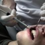Zorgen om Limburgse kinderen die steeds vaker tandartsbezoek overslaan: onbehandelde gaatjes kunnen leiden tot chronische ziektes