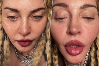 Madonna neemt botox en fillers om jong te ogen, maar Janice Deul vindt Anita Witzier met lachrimpels juist verfrissend