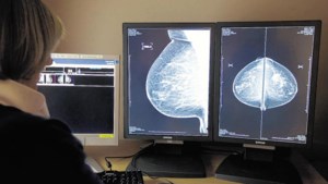 Bevolkingsonderzoek Nederland vanaf juni in Eijsden voor onderzoek borstkanker